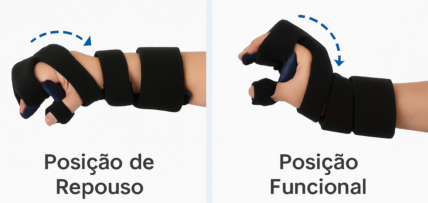 Tala Ortopédica para Mão